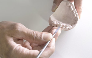  Implantologia e protesi su impianti 